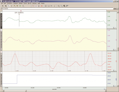 Practical Tips for Recording Physiological Data in MRI