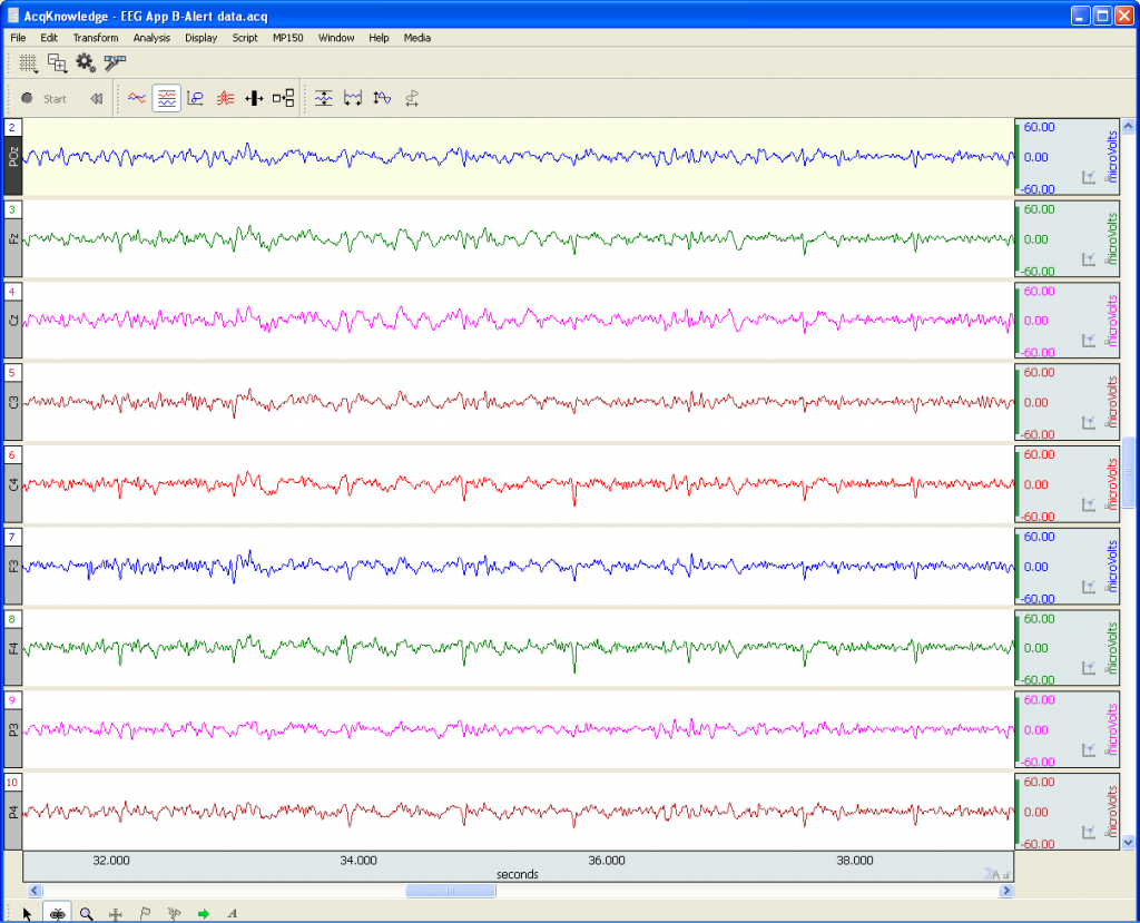 Filtered EEG