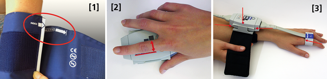 Ensuring Error-free NIBP Measurements & Accurate Data