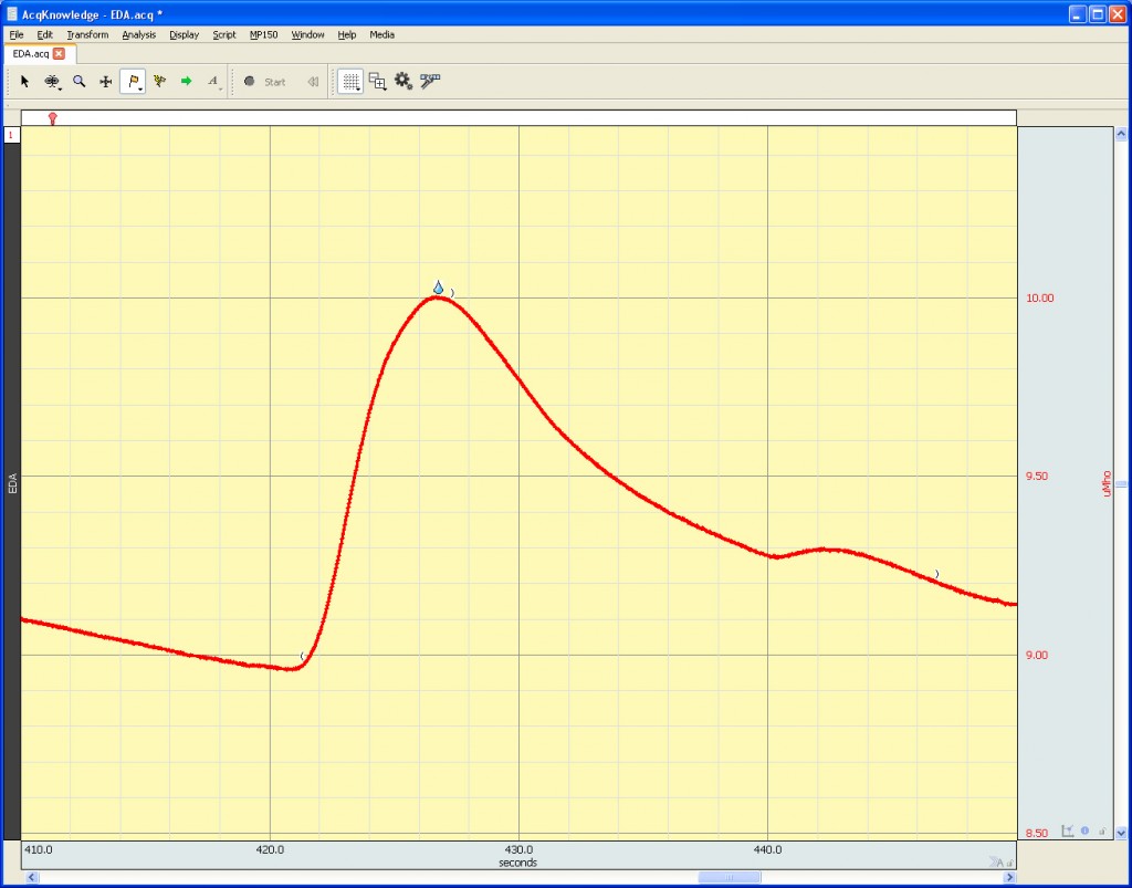 Determining Physiological Cycles for Data Analysis and Extraction
