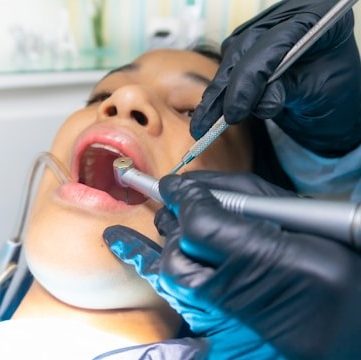 dentalanxiety